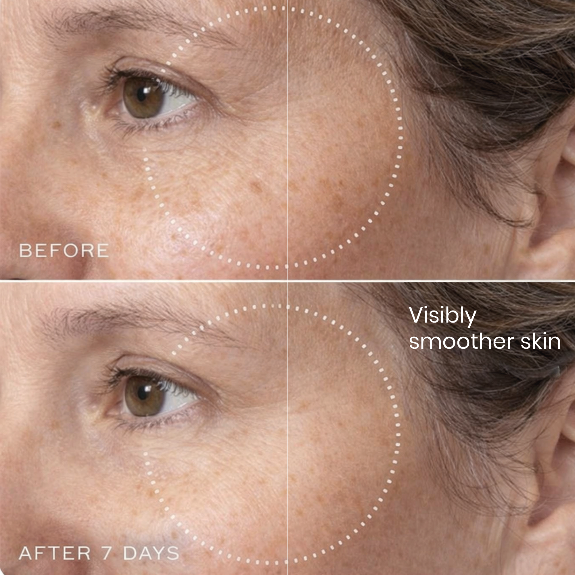 Brightr® Eye wrinkle smoothing patches