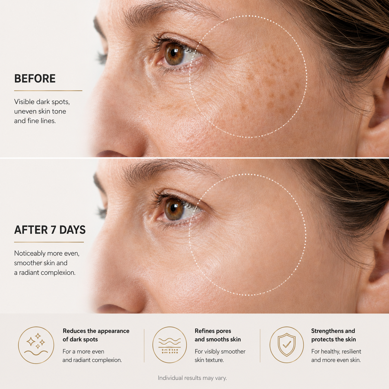 Brightr® Eye wrinkle smoothing patches